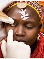 Trachoma patient